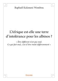 L'Afrique est-elle une terre d'intolérance pour les albinos ?