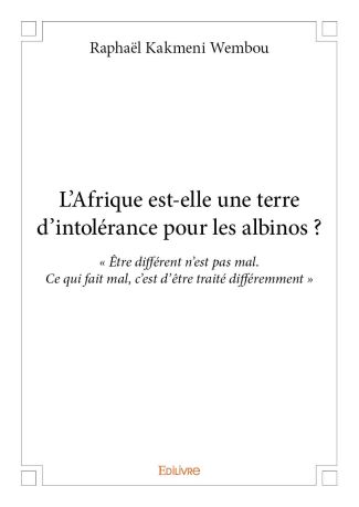 L'Afrique est-elle une terre d'intolérance pour les albinos ?